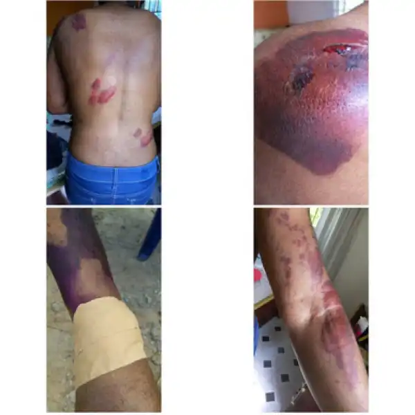 Lady Narrates How Her Husband’s Friend Who Once Tried To Set Her Ablaze Beats Her To Pulp On Christmas Eve (Photos)